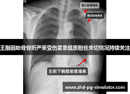王刚因肋骨骨折严重受伤紧急就医粉丝关切情况持续关注